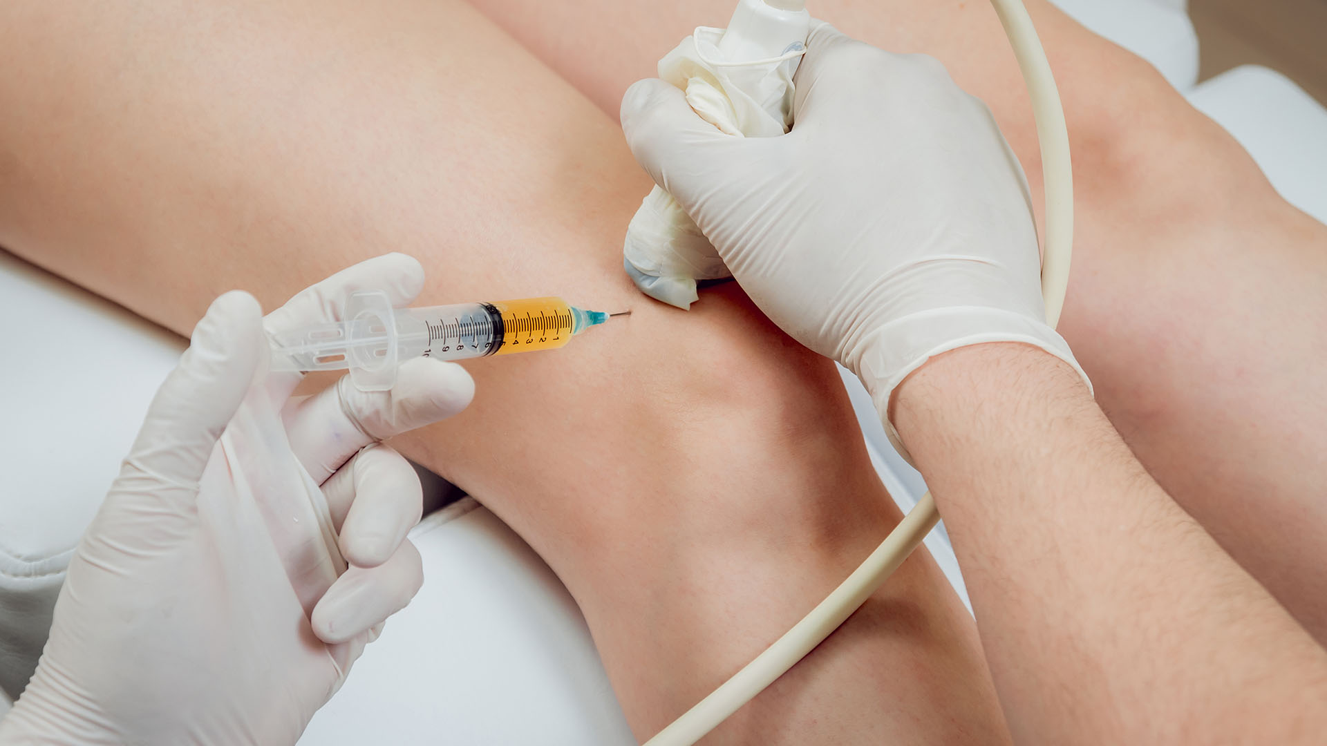 ultrasound injection knee