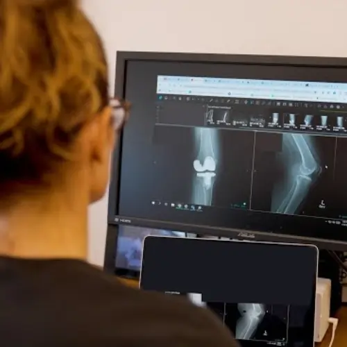 Visco-supplementation Injections for Knee Pain Relief